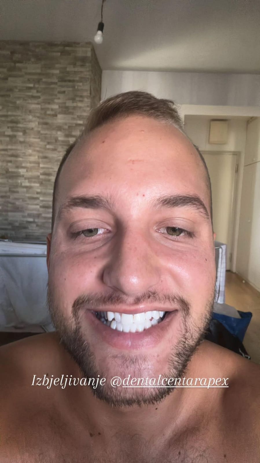 slika žene sa osmijehom